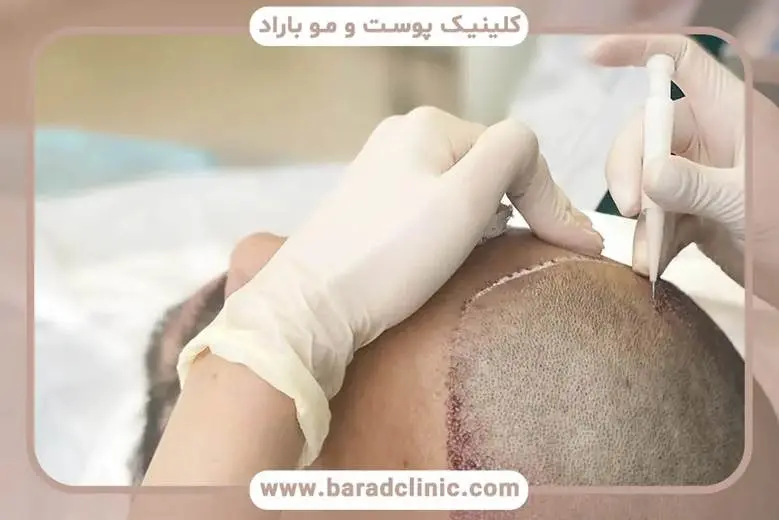 XTGqHSEMir1Cp7nbC5xdRQy3OBTtVFTrwWvD3Ixx