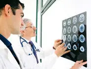 تشخیص زودهنگام سکته مغزی با فناوری جدید