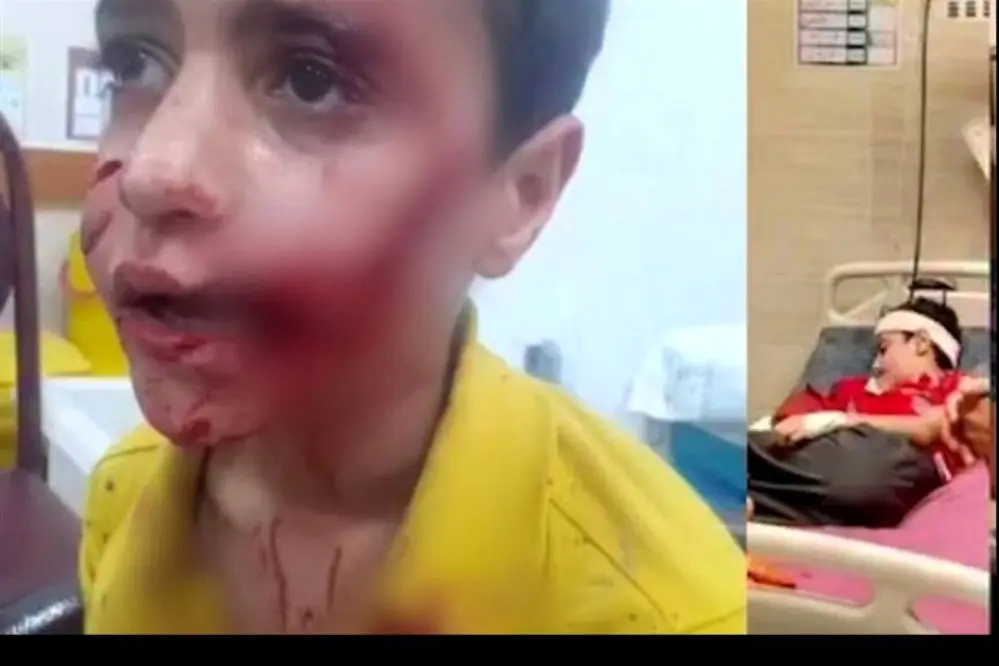 مرگ دلخراش کودک ۱۱ ساله بر اثر حمله سگهای ولگرد در مسجدسلیمان