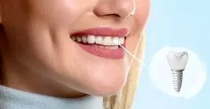 بهترین فوق تخصص ایمپلنت دندان، راهی برای بازگشت به لبخندی زیبا و سالم