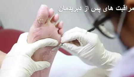 کلینیک زخم: راهکارهای درمان زخم پای دیابتی