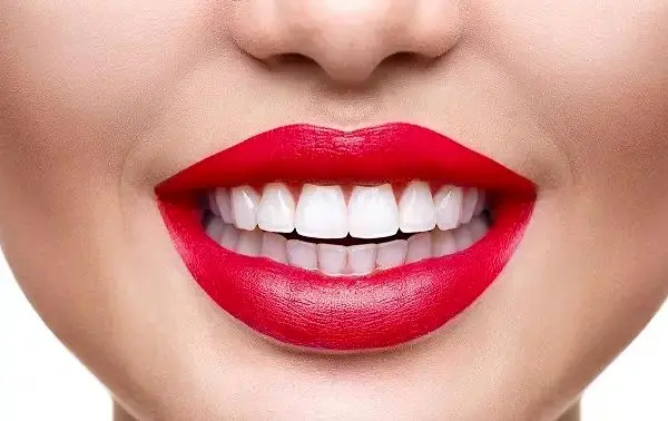 مقایسه کامپوزیت زنیت و توکویاما + قیمت و رنگبندی