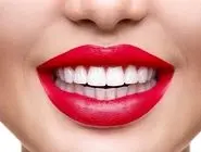 مقایسه کامپوزیت زنیت و توکویاما + قیمت و رنگبندی