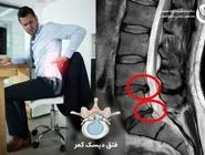 چگونه از دیسک کمر در کار اداری جلوگیری کنیم؟ علائم پنهان و پیشگیری مؤثر