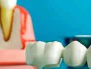 چگونه بهترین متخصص دندانپزشک را انتخاب کنیم؟