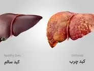 داروی جدید امیدها برای درمان سرطان کبد را افزایش داد